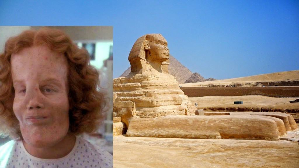 20 Of The Weirdest And Rarest Diseases Known To Mankind Page 8 of 10