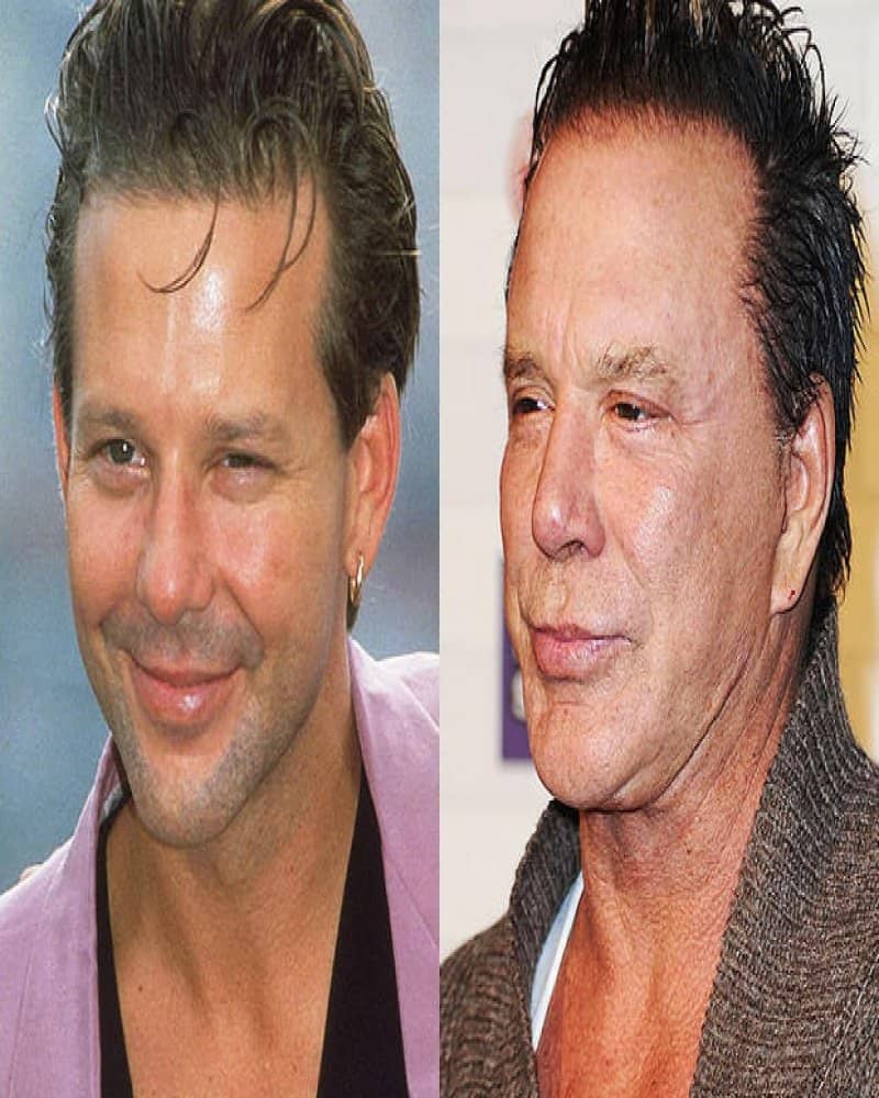 Time Czech Women Are Looking Facial Plastic Surgery Gone Wrong