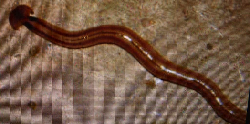 20 Crazy Things Doctors Have Found Inside People’s Bodies - Page 5 of 5