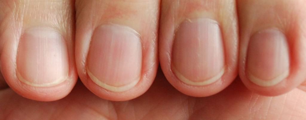 10 things you should about your fingernails.