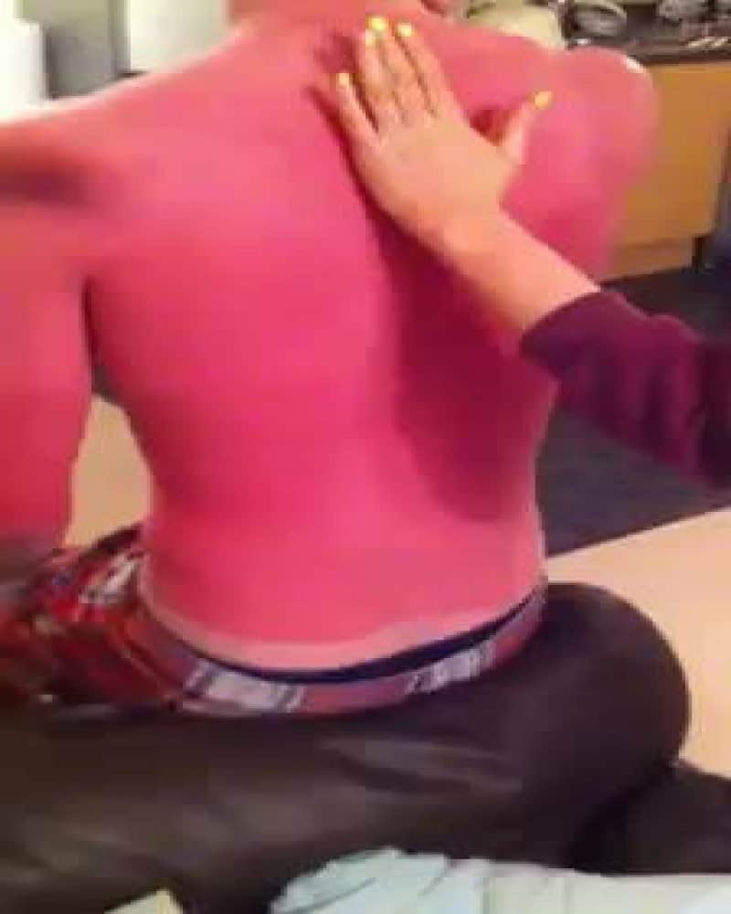 Bilderesultat for worst sunburned