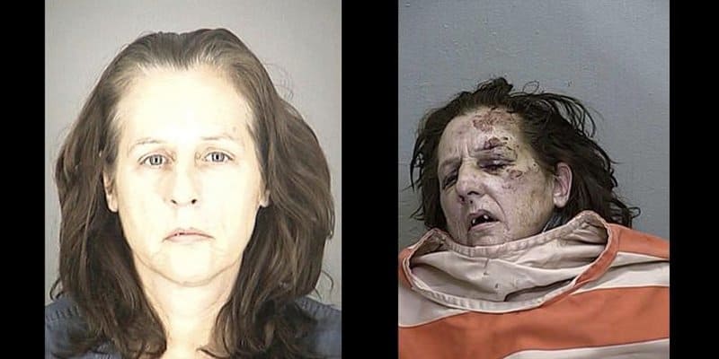 18 Faces That Will Prove Why You Should Stay Away From Meth.